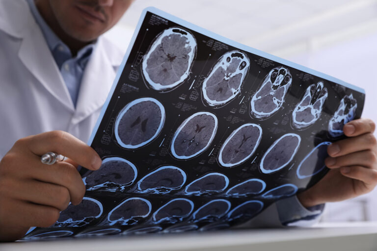 Read what employers need to know about concussions